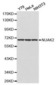 SNARK / NUAK2 Antibody - Western blot analysis of extracts of various cell lines.