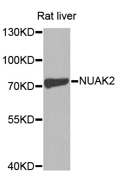 SNARK / NUAK2 Antibody - Western blot analysis of extracts of rat liver, using NUAK2 antibody at 1:1000 dilution. The secondary antibody used was an HRP Goat Anti-Rabbit IgG (H+L) at 1:10000 dilution. Lysates were loaded 25ug per lane and 3% nonfat dry milk in TBST was used for blocking. An ECL Kit was used for detection and the exposure time was 60s.