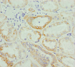 SNARK / NUAK2 Antibody - Immunohistochemistry of paraffin-embedded human kidney tissue at dilution 1:100