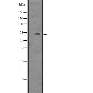 SNARK / NUAK2 Antibody - Western blot analysis of NUAK2 expression in NT2D1 whole cells lysate. The lane on the left is treated with the antigen-specific peptide.