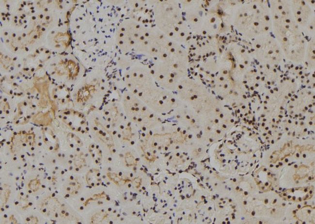 SNARK / NUAK2 Antibody - 1:100 staining rat kidney tissue by IHC-P. The sample was formaldehyde fixed and a heat mediated antigen retrieval step in citrate buffer was performed. The sample was then blocked and incubated with the antibody for 1.5 hours at 22°C. An HRP conjugated goat anti-rabbit antibody was used as the secondary.