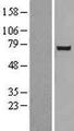 SNARK / NUAK2 Protein - Western validation with an anti-DDK antibody * L: Control HEK293 lysate R: Over-expression lysate