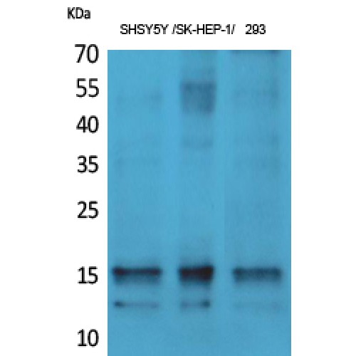 SNCA / Alpha-Synuclein Antibody - Western blot of Phospho-Synuclein-alpha (Y125) antibody