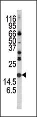 SNCA / Alpha-Synuclein Antibody - Western blot of anti-Alpha-synuclein antibody in mouse brain tissue lysate. Alpha-synuclein (arrow) was detected using the purified antibody.