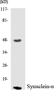 SNCA / Alpha-Synuclein Antibody - Western blot analysis of the lysates from RAW264.7cells using Synuclein-Î± antibody.