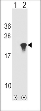 SNCA / Alpha-Synuclein Antibody - Western blot of Park1 (arrow) using rabbit polyclonal Park1 Antibody. 293 cell lysates (2 ug/lane) either nontransfected (Lane 1) or transiently transfected (Lane 2) with the Park1 gene.