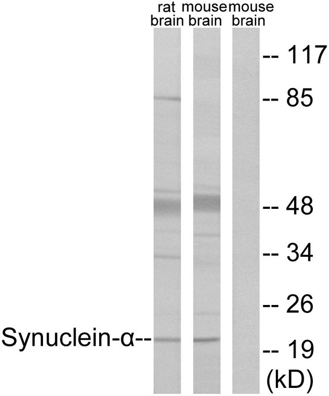 SNCA / Alpha-Synuclein Antibody - Western blot analysis of lysates from rat brain and mouse brain cells, using Synuclein-alpha Antibody. The lane on the right is blocked with the synthesized peptide.