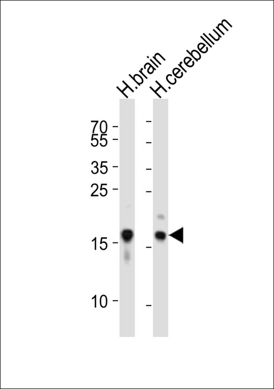 SNCA / Alpha-Synuclein Antibody - Western blot of lysates from human brain, human cerebellum tissue lysate (from left to right), using SNCA antibody diluted at 1:1000 at each lane. A goat anti-rabbit IgG H&L (HRP) at 1:10000 dilution was used as the secondary antibody. Lysates at 20 ug per lane.
