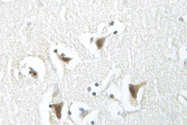 SNCA / Alpha-Synuclein Antibody - IHC of Synuclein- (D119) pAb in paraffin-embedded human brain tissue.