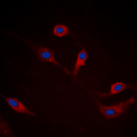 SNCA / Alpha-Synuclein Antibody - Immunofluorescent analysis of Alpha-synuclein (pS129) staining in HEK293T cells. Formalin-fixed cells were permeabilized with 0.1% Triton X-100 in TBS for 5-10 minutes and blocked with 3% BSA-PBS for 30 minutes at room temperature. Cells were probed with the primary antibody in 3% BSA-PBS and incubated overnight at 4 deg C in a humidified chamber. Cells were washed with PBST and incubated with a DyLight 594-conjugated secondary antibody (red) in PBS at room temperature in the dark. DAPI was used to stain the cell nuclei (blue).