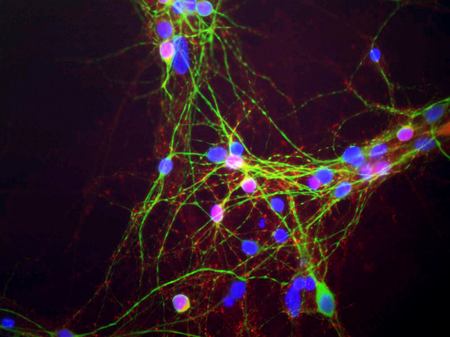 SNCA / Alpha-Synuclein Antibody - Mixed neuron-glial cultures stained with SNCA / Alpha-Synuclein antibody, our monoclonal antibody to alpha-synuclein (red) and chicken polylclonal antibody to MAP2 CPCA-MAP2 (green). The alpha-synuclein antibody stains vesicular structures the perikarya and processes of the neurons in this image. Note that some of the neuronal perikarya contain much more alpha-synuclein than others. The blue channel shows the localization of DNA.