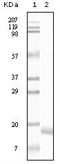 SNCA / Alpha-Synuclein Antibody - alpha Synuclein Antibody in Western Blot (WB)