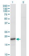 SNCA / Alpha-Synuclein Antibody - Western Blot analysis of SNCA expression in transfected 293T cell line by SNCA monoclonal antibody (M01), clone 2E4.Lane 1: SNCA transfected lysate(14.5 KDa).Lane 2: Non-transfected lysate.