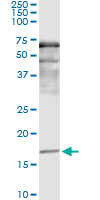 SNCA / Alpha-Synuclein Antibody - Immunoprecipitation of SNCA transfected lysate using anti-SNCA monoclonal antibody and Protein A Magnetic Bead, and immunoblotted with SNCA rabbit polyclonal antibody.