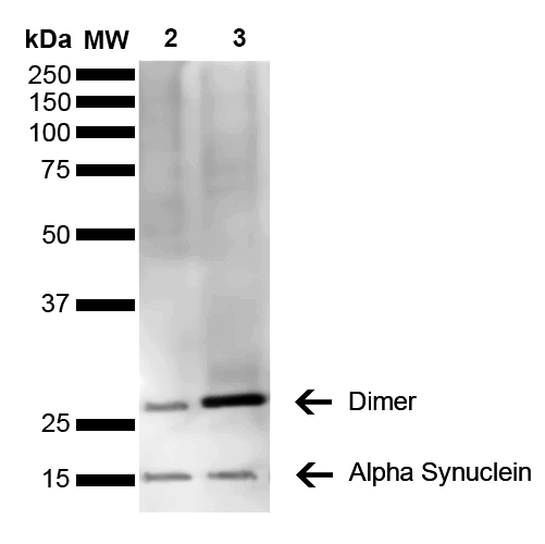 SNCA / Alpha-Synuclein Antibody - Western Blot analysis of Human Brain showing detection of 14 kDa Alpha Synuclein protein using Mouse Anti-Alpha Synuclein Monoclonal Antibody, Clone 3C11. Lane 1: Molecular Weight Ladder (MW). Lane 2: Parkinson brain cell lystate. Lane 3: Human brain cell lysate. Load: 15 µg. Block: 5% Skim Milk in 1X TBST. Primary Antibody: Mouse Anti-Alpha Synuclein Monoclonal Antibody  at 1:1000 for 2 hours at RT. Secondary Antibody: Goat Anti-Mouse HRP:IgG at 1:3000 for 1 hour at RT. Color Development: ECL solution (Super Signal West Pico) for 5 min in RT. Predicted/Observed Size: 14 kDa. Other Band(s): 100 kDa (oligomer).