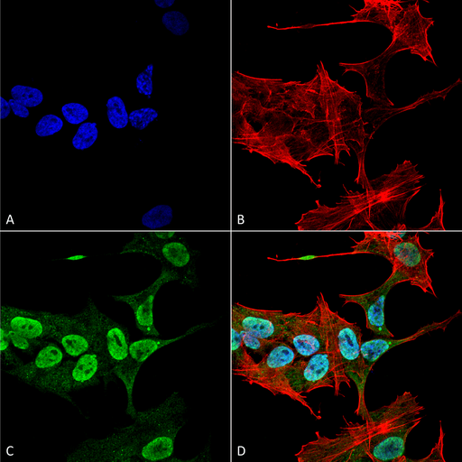 SNCA / Alpha-Synuclein Antibody - Immunocytochemistry/Immunofluorescence analysis using Mouse Anti-Alpha Synuclein Monoclonal Antibody, Clone 3C11. Tissue: Neuroblastoma cell line (SK-N-BE). Species: Human. Fixation: 4% Formaldehyde for 15 min at RT. Primary Antibody: Mouse Anti-Alpha Synuclein Monoclonal Antibody  at 1:100 for 60 min at RT. Secondary Antibody: Goat Anti-Mouse ATTO 488 at 1:200 for 60 min at RT. Counterstain: Phalloidin Texas Red F-Actin stain; DAPI (blue) nuclear stain at 1:1000, 1:5000 for 60 min at RT, 5 min at RT. Localization: Cytoplasm: weak; Nucleus: Med. Magnification: 60X. (A) DAPI (blue) nuclear stain. (B) Phalloidin Texas Red F-Actin stain. (C) Alpha Synuclein Antibody. (D) Composite.