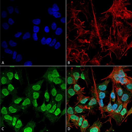 SNCA / Alpha-Synuclein Antibody - Immunocytochemistry/Immunofluorescence analysis using Mouse Anti-Alpha Synuclein Monoclonal Antibody, Clone 3F8. Tissue: Neuroblastoma cell line (SK-N-BE). Species: Human. Fixation: 4% Formaldehyde for 15 min at RT. Primary Antibody: Mouse Anti-Alpha Synuclein Monoclonal Antibody  at 1:100 for 60 min at RT. Secondary Antibody: Goat Anti-Mouse ATTO 488 at 1:200 for 60 min at RT. Counterstain: Phalloidin Texas Red F-Actin stain; DAPI (blue) nuclear stain at 1:1000, 1:5000 for 60 min at RT, 5 min at RT. Localization: Cytoplasm: weak; Nucleus: Med. Magnification: 60X. (A) DAPI (blue) nuclear stain. (B) Phalloidin Texas Red F-Actin stain. (C) Alpha Synuclein Antibody. (D) Composite.