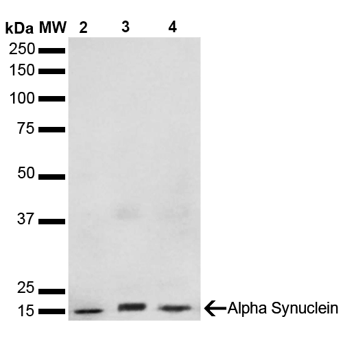 SNCA / Alpha-Synuclein Antibody - Western Blot analysis of Human, Mouse, Rat Brain showing detection of 14 kDa Alpha Synuclein protein using Mouse Anti-Alpha Synuclein Monoclonal Antibody, Clone 3F8. Lane 1: Molecular Weight Ladder (MW). Lane 2: Mouse Brain cell lysate. Lane 3: Rat brain cell lysate. Lane 4: Human brain cell lysate. Load: 15 µg. Block: 5% Skim Milk in 1X TBST. Primary Antibody: Mouse Anti-Alpha Synuclein Monoclonal Antibody  at 1:1000 for 2 hours at RT. Secondary Antibody: Goat Anti-Mouse HRP:IgG at 1:3000 for 1 hour at RT. Color Development: ECL solution (Super Signal West Pico) for 5 min in RT. Predicted/Observed Size: 14 kDa.