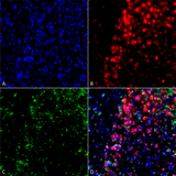 SNCA / Alpha-Synuclein Antibody - Immunocytochemistry/Immunofluorescence analysis using Mouse Anti-Alpha Synuclein Monoclonal Antibody, Clone 3F8. Tissue: Primary hippocampal neurons treated with active Alpha Synuclein Protein Aggregate (SPR-322) at 4 µg/ml to induce fibrils. Species: Rat. Fixation: 4% paraformaldehyde. Primary Antibody: Mouse Anti-Alpha Synuclein Monoclonal Antibody  at 1:200 for 24 hours at 4°C. Secondary Antibody: Goat Anti-Mouse Alexa Fluor 488 at 1:700 for 1 hour at RT. Counterstain: Guinea Pig Anti-NeuN (red) neuronal marker (Donkey Anti-Guinea Pig Alexa Fluor 647 1:700); DAPI (blue) nuclear stain at 1:6000, 1:3000 for 60 min at RT, 5 min at RT. Magnification: 20X. (A) DAPI (blue) nuclear stain. (B) NeuN neuronal marker (red). (C) Alpha Synuclein Antibody. (D) Composite.
