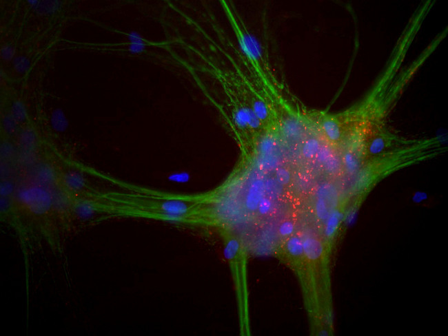 SNCA / Alpha-Synuclein Antibody - Mixed neuron-glial cultures stained with SNCA / Alpha-Synuclein antibody, our monoclonal antibody to alpha-synuclein (red) and chicken polylclonal antibody to MAP2 CPCA-MAP2 (green). The alpha-synuclein antibody stains vesicular structures the perikarya and processes of the neurons in this image.
