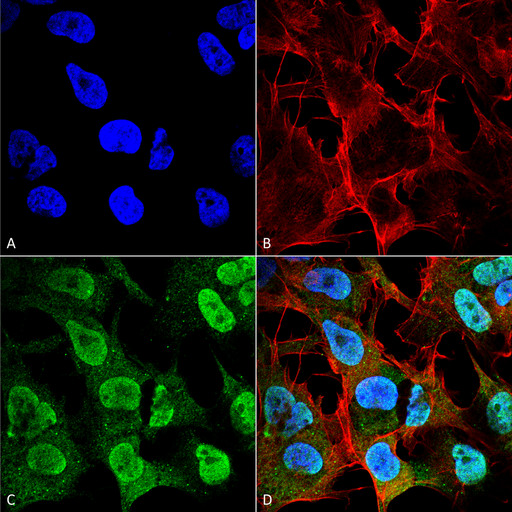 SNCA / Alpha-Synuclein Antibody - Immunocytochemistry/Immunofluorescence analysis using Mouse Anti-Alpha Synuclein Monoclonal Antibody, Clone 4F1. Tissue: Neuroblastoma cell line (SK-N-BE). Species: Human. Fixation: 4% Formaldehyde for 15 min at RT. Primary Antibody: Mouse Anti-Alpha Synuclein Monoclonal Antibody  at 1:100 for 60 min at RT. Secondary Antibody: Goat Anti-Mouse ATTO 488 at 1:200 for 60 min at RT. Counterstain: Phalloidin Texas Red F-Actin stain; DAPI (blue) nuclear stain at 1:1000, 1:5000 for 60 min at RT, 5 min at RT. Localization: Cytoplasm: medium; Nucleus: strong. Magnification: 60X. (A) DAPI (blue) nuclear stain. (B) Phalloidin Texas Red F-Actin stain. (C) Alpha Synuclein Antibody. (D) Composite.