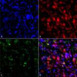 SNCA / Alpha-Synuclein Antibody - Immunocytochemistry/Immunofluorescence analysis using Mouse Anti-Alpha Synuclein Monoclonal Antibody, Clone 4F1. Tissue: Primary hippocampal neurons treated with active Alpha Synuclein Protein Aggregate (SPR-322) at 4 µg/ml to induce fibrils. Species: Rat. Fixation: 4% paraformaldehyde. Primary Antibody: Mouse Anti-Alpha Synuclein Monoclonal Antibody  at 1:200 for 24 hours at 4°C. Secondary Antibody: Goat Anti-Mouse Alexa Fluor 488 at 1:700 for 1 hour at RT. Counterstain: Guinea Pig Anti-NeuN (red) neuronal marker (Donkey Anti-Guinea Pig Alexa Fluor 647 1:700); DAPI (blue) nuclear stain at 1:6000, 1:3000 for 60 min at RT, 5 min at RT. Magnification: 20X. (A) DAPI (blue) nuclear stain. (B) NeuN neuronal marker (red). (C) Alpha Synuclein Antibody. (D) Composite.