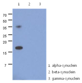 SNCA / Alpha-Synuclein Antibody - Western Blot: The recombinant human synuclein family (alpha-, beta- and gamma-) proteins (100ng) were resolved by SDS-PAGE, transferred to PVDF membrane and probed with anti-human alpha-synuclein antibody (1:500). Proteins were visualized using a goat anti-mouse secondary antibody conjugated to HRP and an ECL detection system.