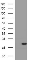 SNCA / Alpha-Synuclein Antibody - HEK293T cells were transfected with the pCMV6-ENTRY control (Left lane) or pCMV6-ENTRY SNCA (Right lane) cDNA for 48 hrs and lysed. Equivalent amounts of cell lysates (5 ug per lane) were separated by SDS-PAGE and immunoblotted with anti-SNCA.