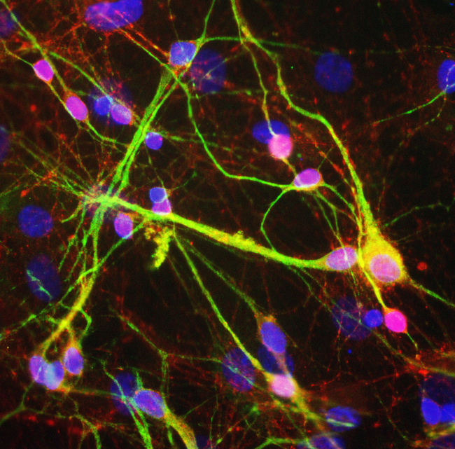 SNCA / Alpha-Synuclein Antibody - Mixed rat neuron-glial cultures stained with SNCA / Alpha-Synuclein antibody, polyclonal antibody to alpha-synuclein (red) and monoclonal antibody to MAP2 4H5 (green). The alpha-synuclein antibody stains vesicular structures the perikarya and processes of the neurons in this image. Note that some of the neuronal perikarya contain much more alpha-synuclein than others. The blue channel shows the localization of DNA.