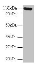SNCA / Alpha-Synuclein Antibody - Western blot All lanes: Alpha-synuclein antibody at 2µg/ml + 293T whole cell lysate Secondary Goat polyclonal to rabbit IgG at 1/15000 dilution Predicted band size: 15, 12, 14 kDa Observed band size: 55, 118 kDa