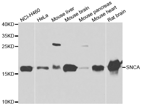 SNCA / Alpha-Synuclein Antibody - Western blot analysis of extracts of various cell lines.