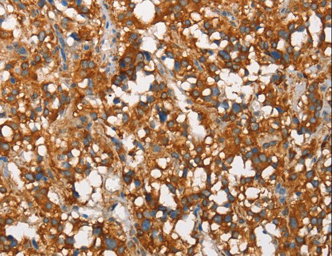 SNCA / Alpha-Synuclein Antibody - Immunohistochemistry of paraffin-embedded Human brain using SNCA Polyclonal Antibody at dilution of 1:60.