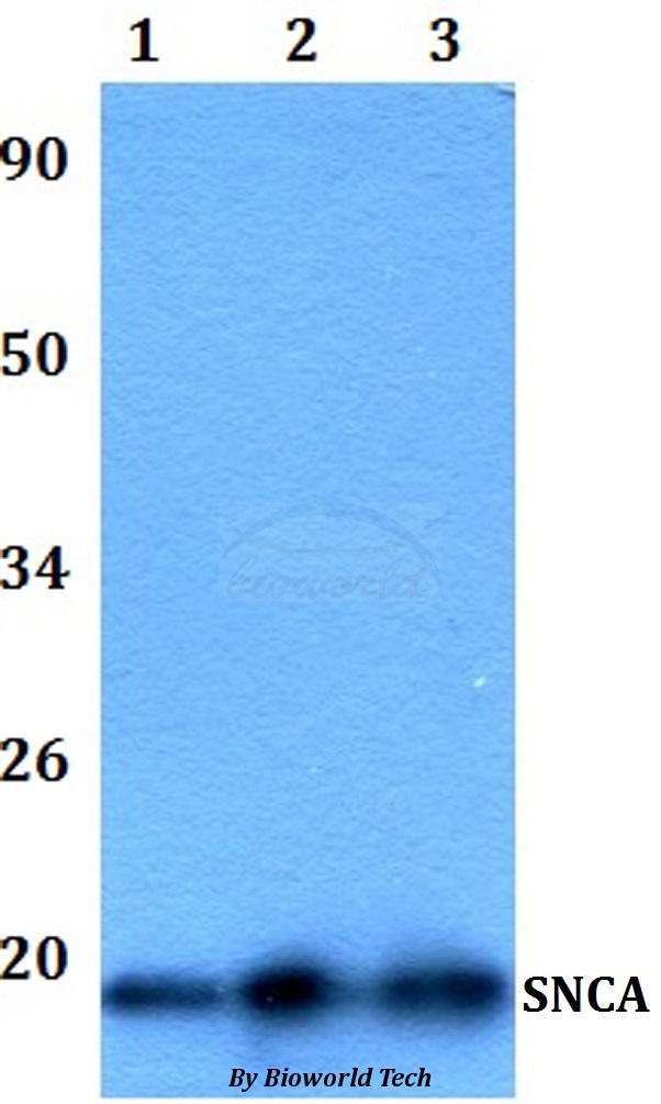 SNCA / Alpha-Synuclein Antibody - Western blot of SNCA antibody at 1:500 dilution. Lane 1: HEK293T whole cell lysate. Lane 2: RAW264.7 whole cell lysate.