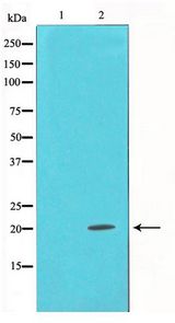 SNCA / Alpha-Synuclein Antibody - Western blot of mouse brain cell lysate using Alpha-synuclein Antibody