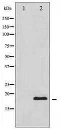 SNCA / Alpha-Synuclein Antibody - Western blot of Synuclein expression in HUVEC whole cell lysates,The lane on the left is treated with the antigen-specific peptide.