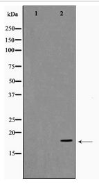 SNCA / Alpha-Synuclein Antibody - Western blot of Synuclein-alpha expression in Etoposide treated 293 whole cell lysates,The lane on the left is treated with the antigen-specific peptide.