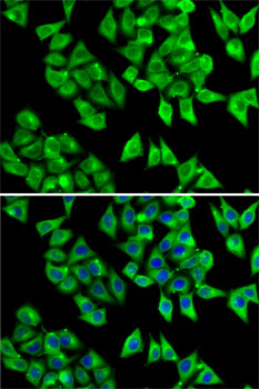 SNCA / Alpha-Synuclein Antibody - Immunofluorescence analysis of A-549 cells using SNCA antibody. Blue: DAPI for nuclear staining.