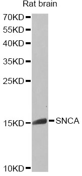 SNCA / Alpha-Synuclein Antibody - Western blot analysis of extracts of rat brain, using SNCA antibody at 1:1000 dilution. The secondary antibody used was an HRP Goat Anti-Rabbit IgG (H+L) at 1:10000 dilution. Lysates were loaded 25ug per lane and 3% nonfat dry milk in TBST was used for blocking. An ECL Kit was used for detection and the exposure time was 90s.