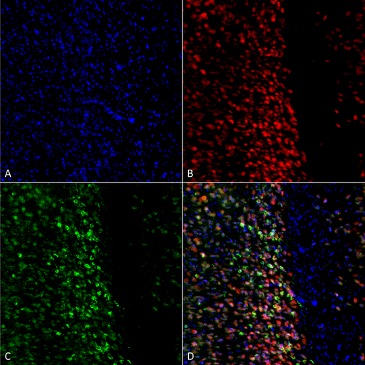 SNCA / Alpha-Synuclein Antibody - Immunocytochemistry/Immunofluorescence analysis using Rabbit Anti-Alpha Synuclein pSer129 Polyclonal Antibody. Tissue: Primary hippocampal neurons treated with active Alpha Synuclein Protein Aggregate (SPR-322) at 4 µg/ml to induce fibrils. Species: Rat. Fixation: 4% paraformaldehyde. Primary Antibody: Rabbit Anti-Alpha Synuclein pSer129 Polyclonal Antibody  at 1:500 for 24 hours at 4°C. Secondary Antibody: Goat Anti-Rabbit Alexa Fluor 488 at 1:700 for 1 hour at RT. Counterstain: Guinea Pig Anti-NeuN (red) neuronal marker (Donkey Anti-Guinea Pig Alexa Fluor 647 1:700); Hoechst (blue) nuclear stain at 1:6000, 1:3000 for 60 min at RT, 5 min at RT. Magnification: 20X.