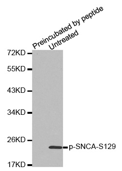 SNCA / Alpha-Synuclein Antibody - Western blot analysis of extracts from mouse brain tissue.