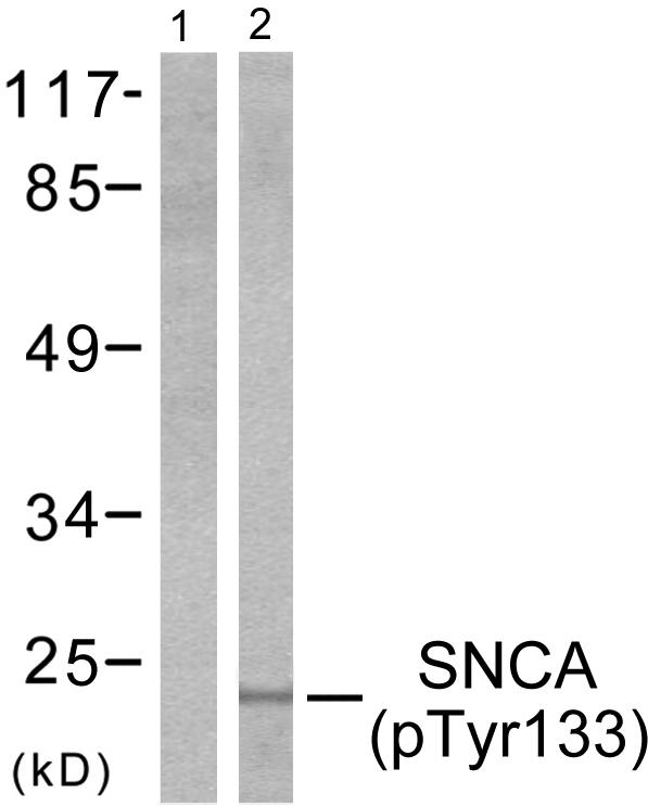 SNCA / Alpha-Synuclein Antibody - Western blot analysis of lysates from 293 cells treated with Etoposide 25 muM 60', using Synuclein-alpha (Phospho-Tyr133) Antibody. The lane on the left is blocked with the phospho peptide.