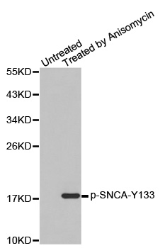 SNCA / Alpha-Synuclein Antibody - Western blot analysis of extracts from C2C12 cells.