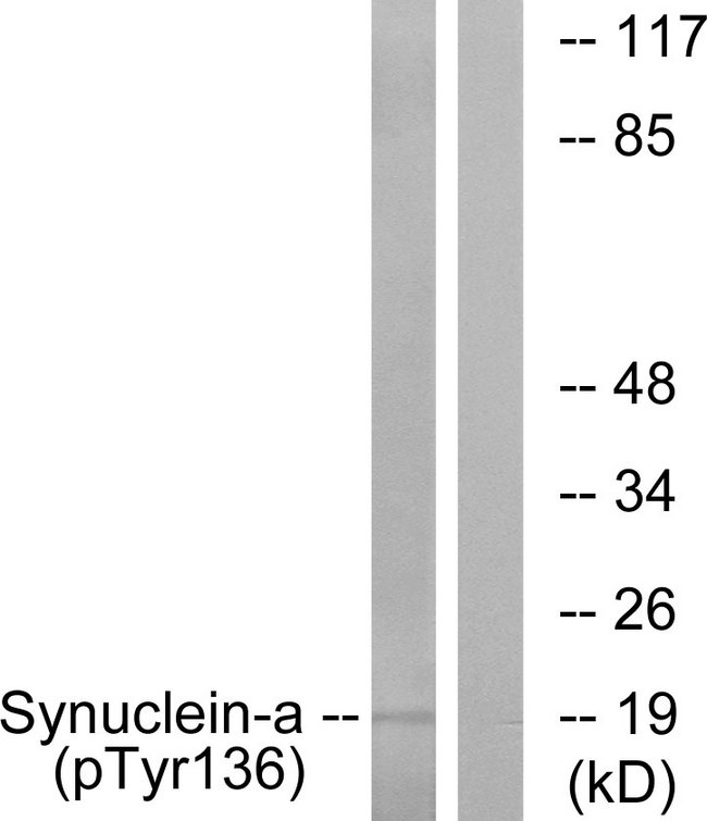 SNCA / Alpha-Synuclein Antibody - Western blot analysis of lysates from mouse brain, using Synuclein-alpha (Phospho-Tyr136) Antibody. The lane on the right is blocked with the phospho peptide.