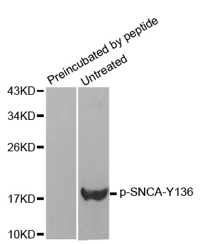 SNCA / Alpha-Synuclein Antibody - Western blot analysis of extracts from mouse brain tissue.