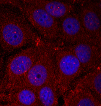 SNCA / Alpha-Synuclein Antibody - Immunofluorescence staining of methanol-fixed Hela cells.