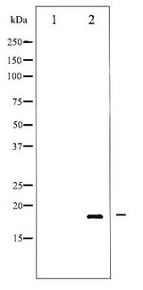 SNCA / Alpha-Synuclein Antibody - Western blot of Synuclein- alpha phosphorylation expression in Mouse brain tissue lysates,The lane on the left is treated with the antigen-specific peptide.