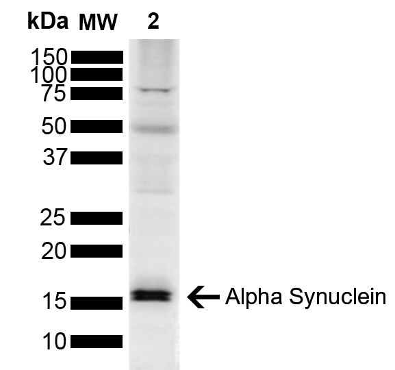 SNCA / Alpha-Synuclein Antibody - Western blot analysis of Mouse Brain showing detection of ~14.46kDa Alpha Synuclein protein using Rabbit Anti-Alpha Synuclein Polyclonal Antibody. Lane 1: Molecular Weight Ladder (MW). Lane 2: Mouse Brain. Load: 15 µg. Block: 5% Skim Milk powder in TBST. Primary Antibody: Rabbit Anti-Alpha Synuclein Polyclonal Antibody  at 1:1000 for 2 hours at RT with shaking. Secondary Antibody: Goat anti-rabbit IgG:HRP at 1:4000 for 1 hour at RT with shaking. Color Development: Chemiluminescent for HRP (Moss) for 5 min in RT. Predicted/Observed Size: ~14.46kDa. Other Band(s): Higher molecular weight oligomers.