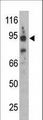 SNCAIP / Synphilin 1 Antibody - The anti-Synphilin-1 C-term antibody is used in Western blot to detect Synphilin-1 in mouse brain lysate.