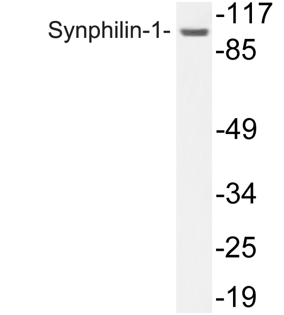 SNCAIP / Synphilin 1 Antibody - Western blot analysis of lysate from COLO205, using Synphilin-1 antibody.
