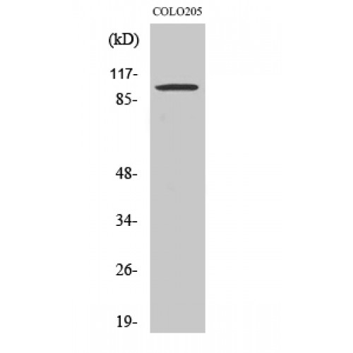 SNCAIP / Synphilin 1 Antibody - Western blot of Synphilin-1 antibody